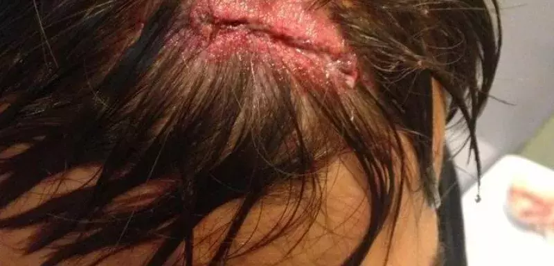 Le traitement médiatique général est trop souvent à charge pour les Ultras comme le montre la majorité des articles rédigés sur les violences policières encaissées au stade d'Olympiakos. (DR) Le traitement médiatique général est trop souvent à charge pour les Ultras comme le montre la majorité des articles rédigés sur les violences policières encaissées au stade d'Olympiakos. (DR)