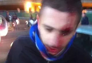 "Violence" policière "gratuite" à la sortie du match Toulouse-Montpellier, selon Casti et les autres supporters montpelliérains présents sur ce nouveau derby. (© CF/Médiaterranée)