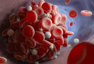 Les scientifiques ont identifié une raison possible pour laquelle le vaccin AstraZeneca peut provoquer des caillots sanguins (Photo : DR) 