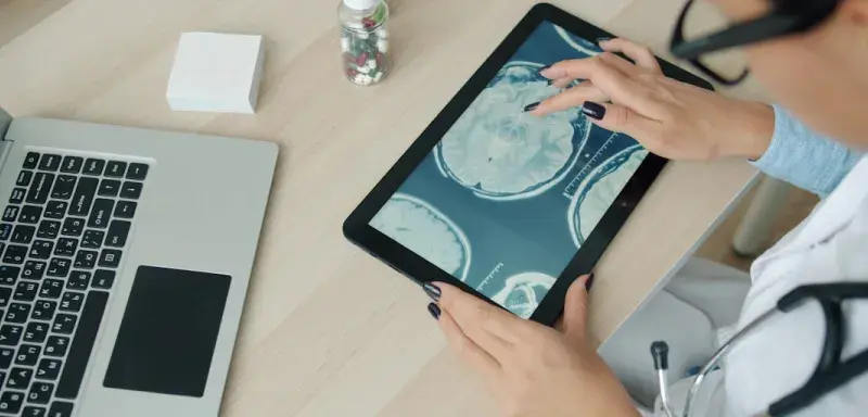 Doctor examining brain scan on tablet at desk.
