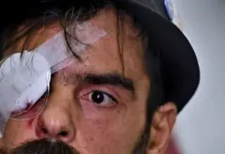 Illustration procès du policier accusé d'avoir éborgné Jérôme Rodrigues lors du mouvement des gilets jaunes