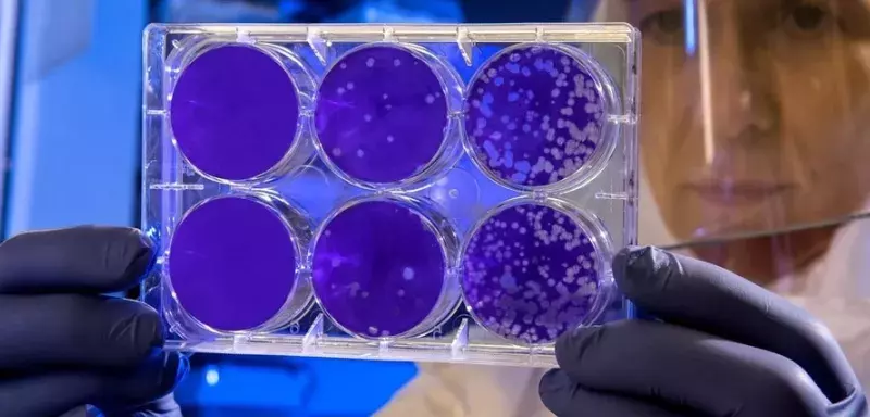 Le coronavirus inventé par un laboratoire français ? Buzz ou réalité ? La pandémie serait-elle provoquée par des laboratoires en quête de profits ?  