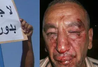  Un des organisateurs, Khaled Boudjemaa, qui a été violemment agressé (Photo: page facebook de nawaat.org) 